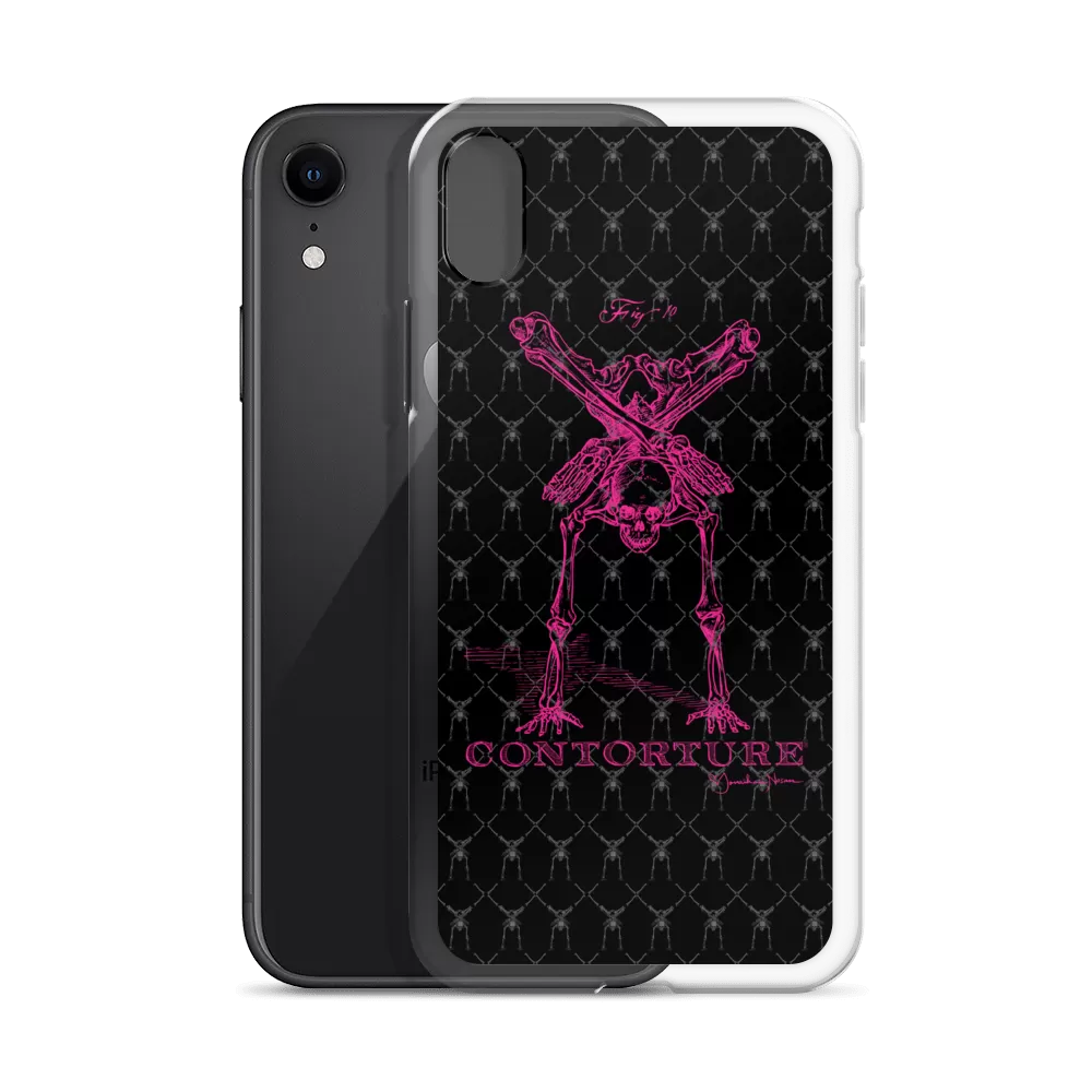 Contorture iPhone Case: Pinky Contortion Skeleton