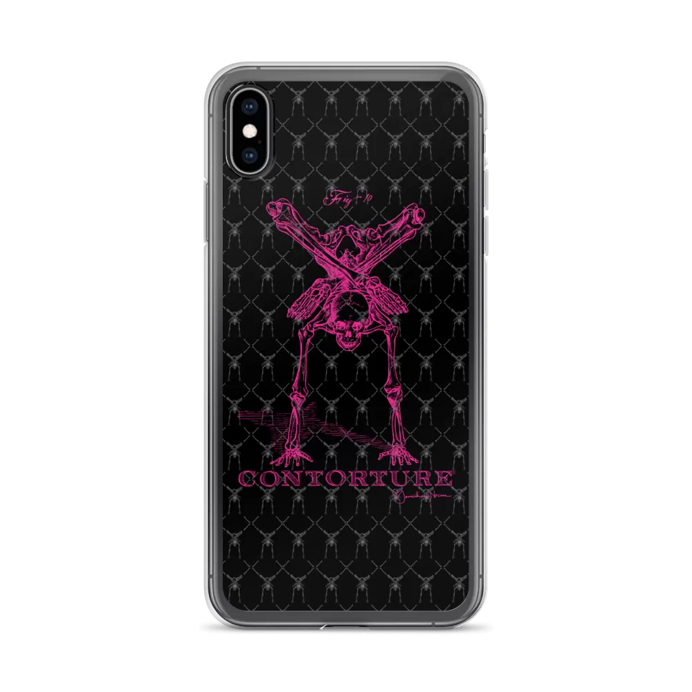 Contorture iPhone Case: Pinky Contortion Skeleton