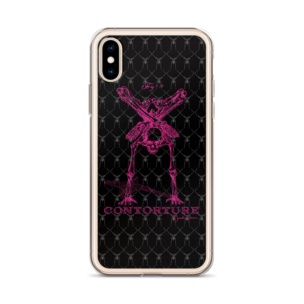 Contorture iPhone Case: Pinky Contortion Skeleton