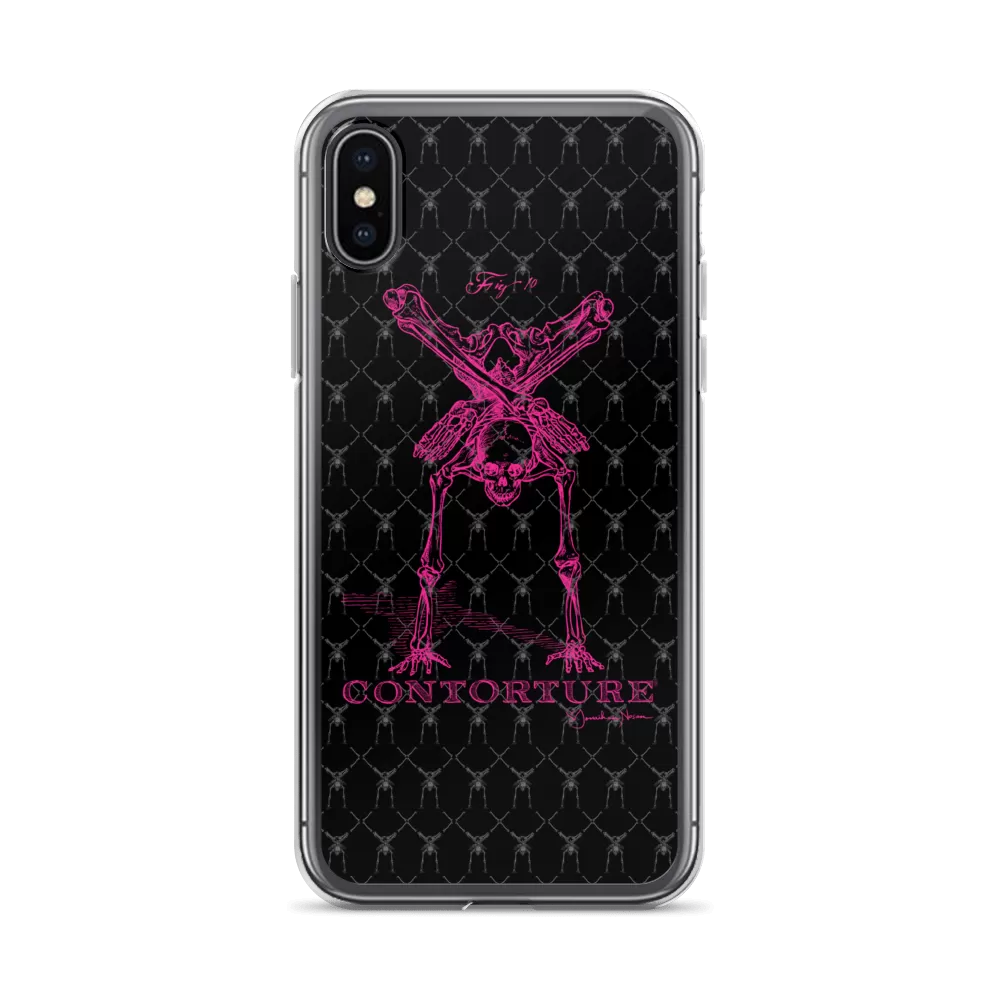 Contorture iPhone Case: Pinky Contortion Skeleton