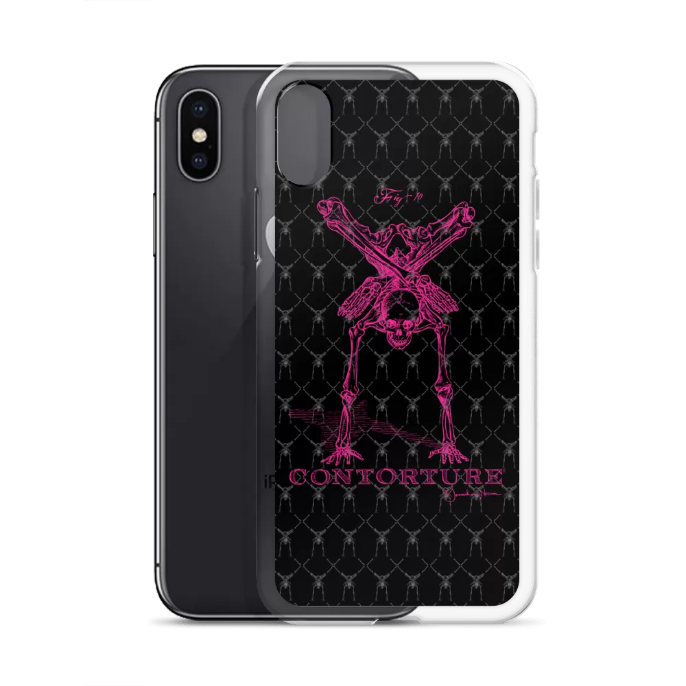 Contorture iPhone Case: Pinky Contortion Skeleton