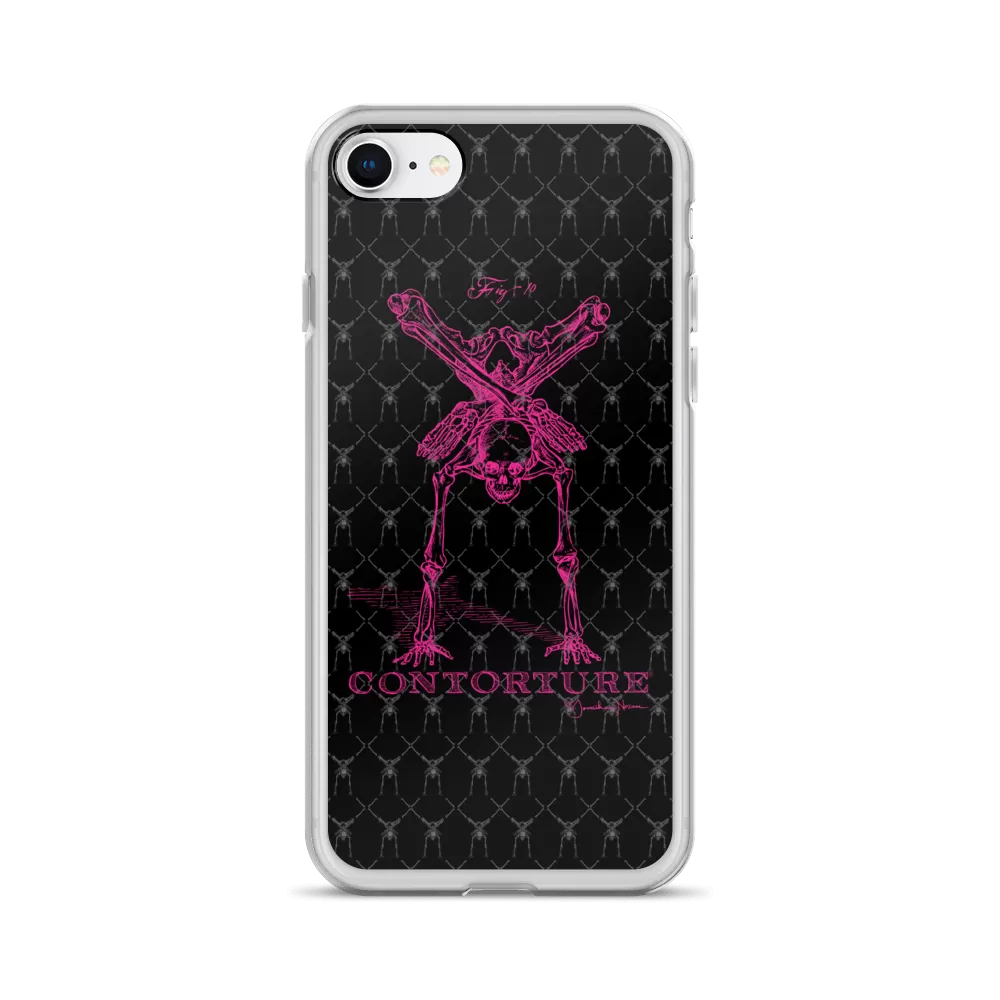 Contorture iPhone Case: Pinky Contortion Skeleton