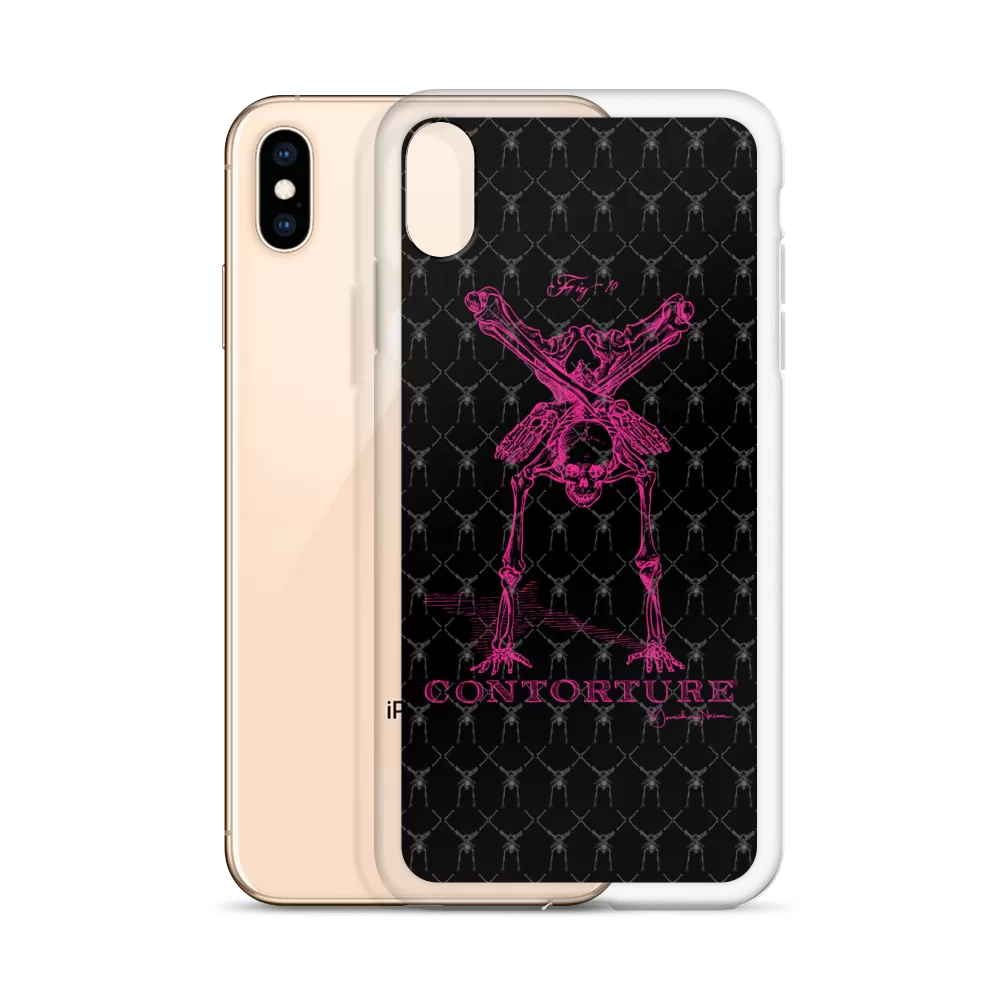 Contorture iPhone Case: Pinky Contortion Skeleton