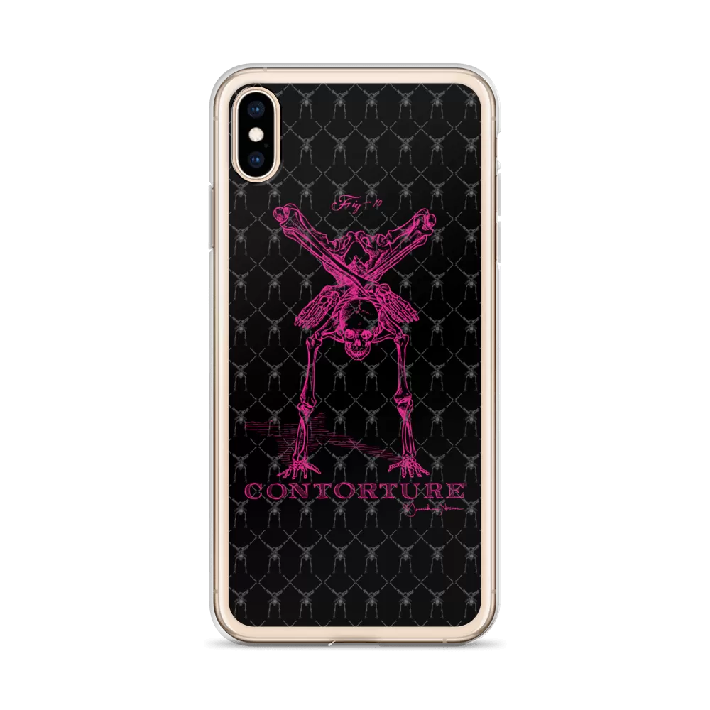 Contorture iPhone Case: Pinky Contortion Skeleton