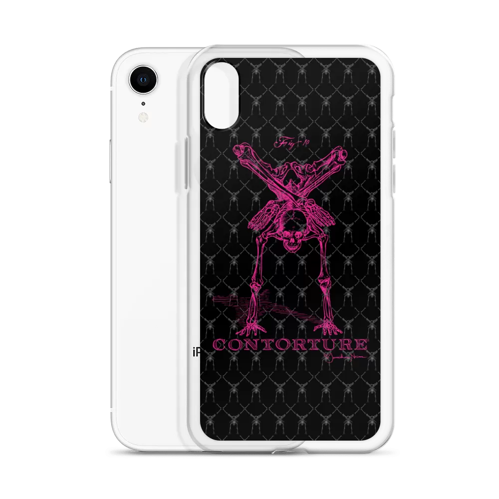 Contorture iPhone Case: Pinky Contortion Skeleton