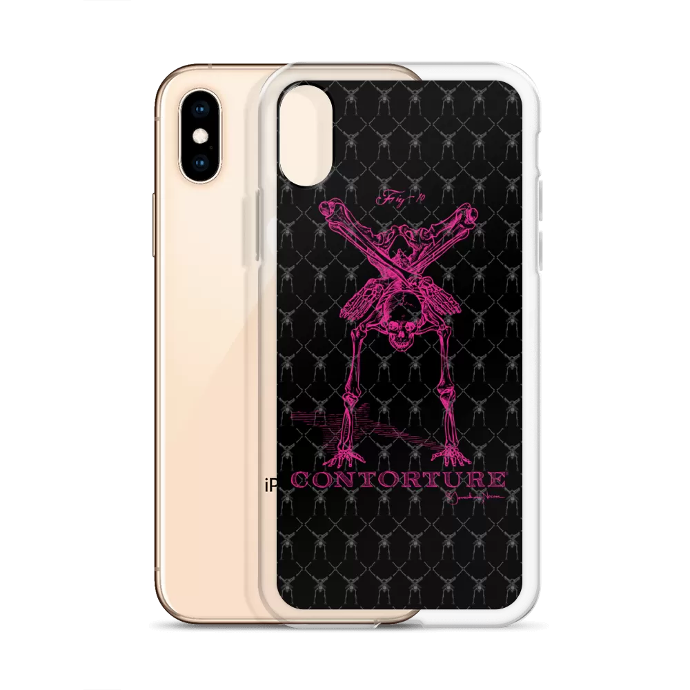 Contorture iPhone Case: Pinky Contortion Skeleton