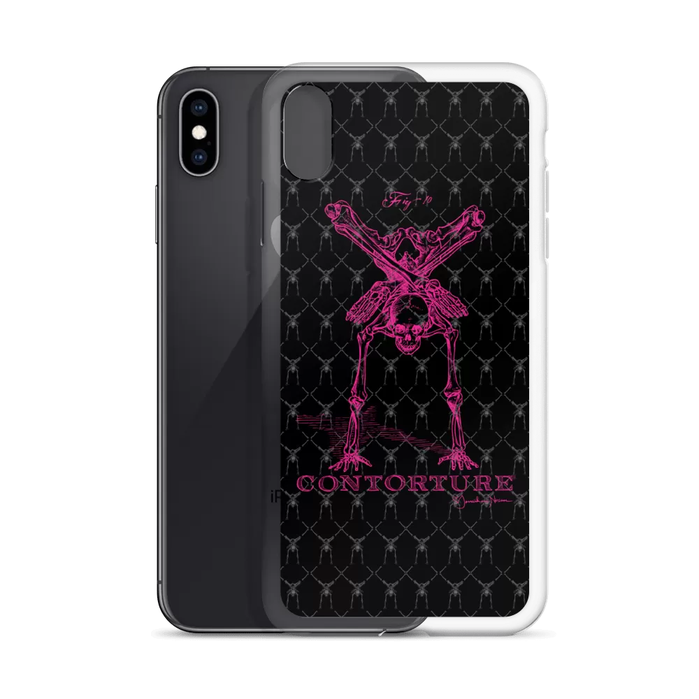 Contorture iPhone Case: Pinky Contortion Skeleton